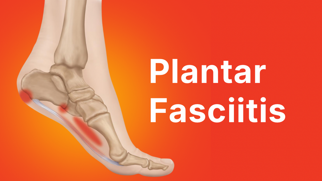 Plantar Fasciitis Explained: Why Your Heel Hurts and How to Actually Fix It